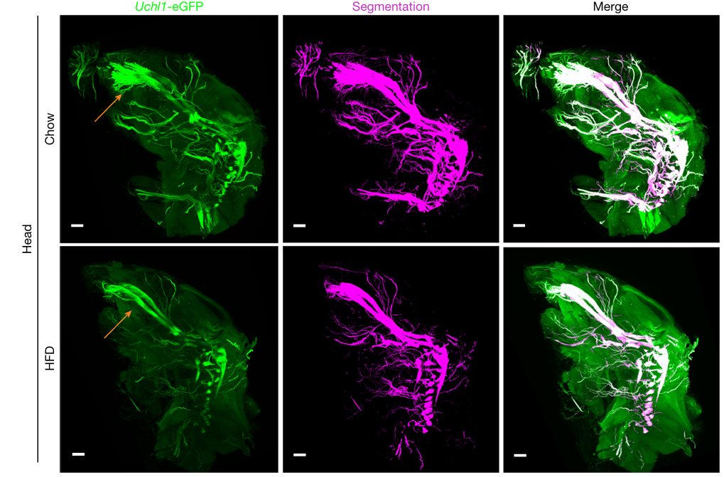 Fluorescent microscopy images showing tissue inflammation patterns in obese vs. lean mice